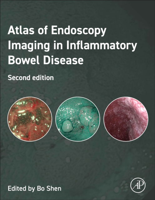 Cover for Bo Shen · Atlas of Endoscopy Imaging in Inflammatory Bowel Disease (Hardcover Book) (2025)
